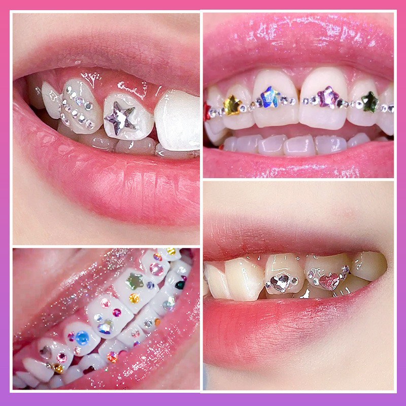 NEW Professional Tooth Gem Kit - đánh giá và giá Tooth Gem Kit