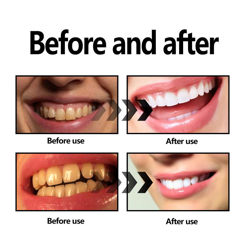 Teeth Whitening Powder Charcoa - đánh giá và giá Teeth Whitening With Baking Soda