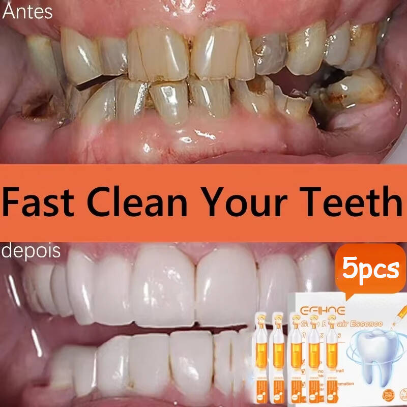 Quickly Repair Gum Serum Relie - đánh giá và giá Teeth Whitening With Baking Soda