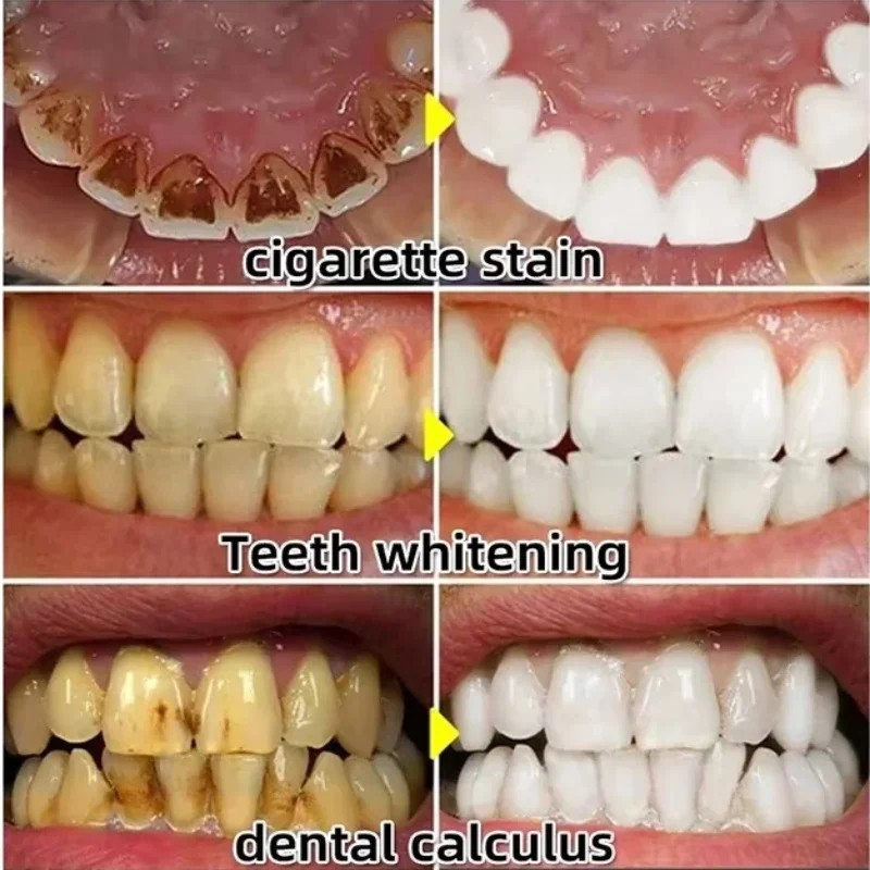Quickly Repair Gum Serum Relie - đánh giá và giá Teeth Whitening With Baking Soda