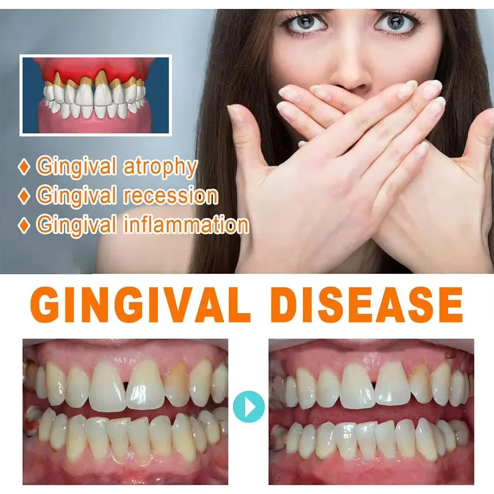 Quickly Repair Gum Serum Relie - đánh giá và giá Teeth Whitening With Baking Soda