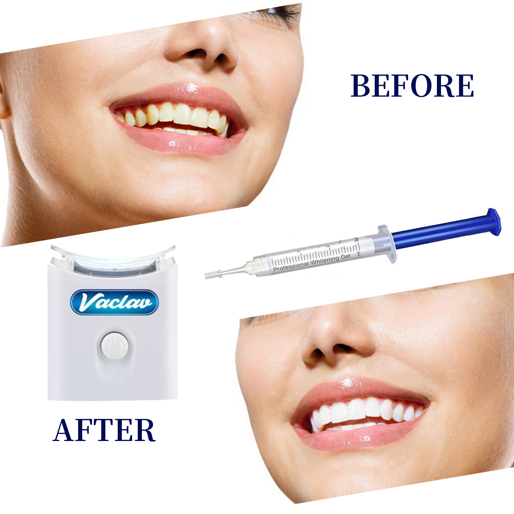 Mint Teeth Whitening Gel Syrin - đánh giá và giá Teeth Whitening With Baking Soda