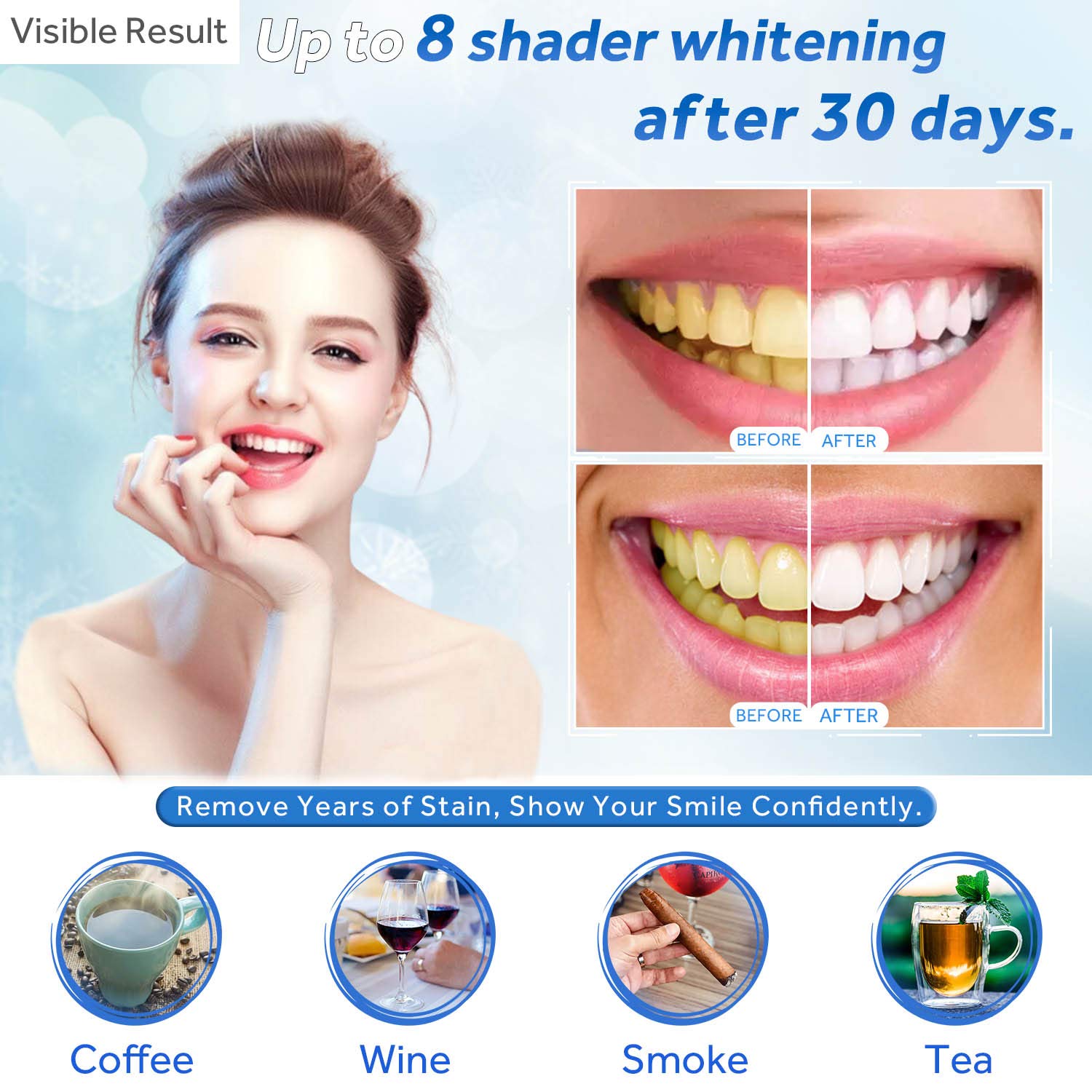 Teeth Whitening Gel Refill Syr - đánh giá và giá Teeth Whitening Price