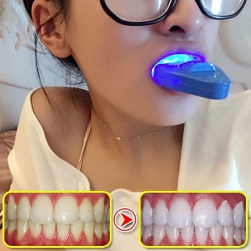 LED Teeth Whitening Light Whit - đánh giá và giá Teeth Whitening Uv Kit