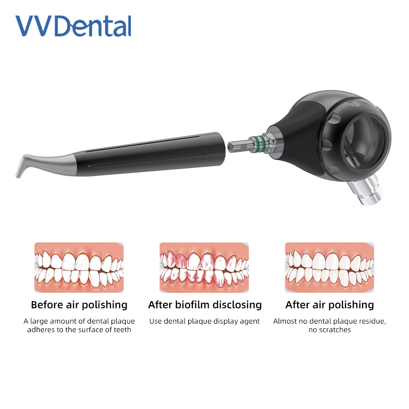 VVDental Air Polisher Jet Air  - đánh giá và giá Colgate Whitening Teeth