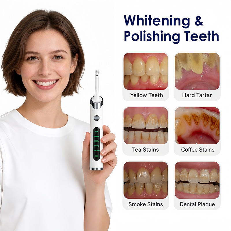 Tooth Polisher Teeth Whitening - đánh giá và giá Teeth Whitening Kit With Light
