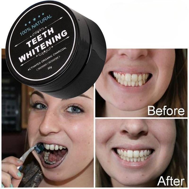 1 Box Activated Charcoal Teeth - đánh giá và giá Teeth Whitening Ingredients