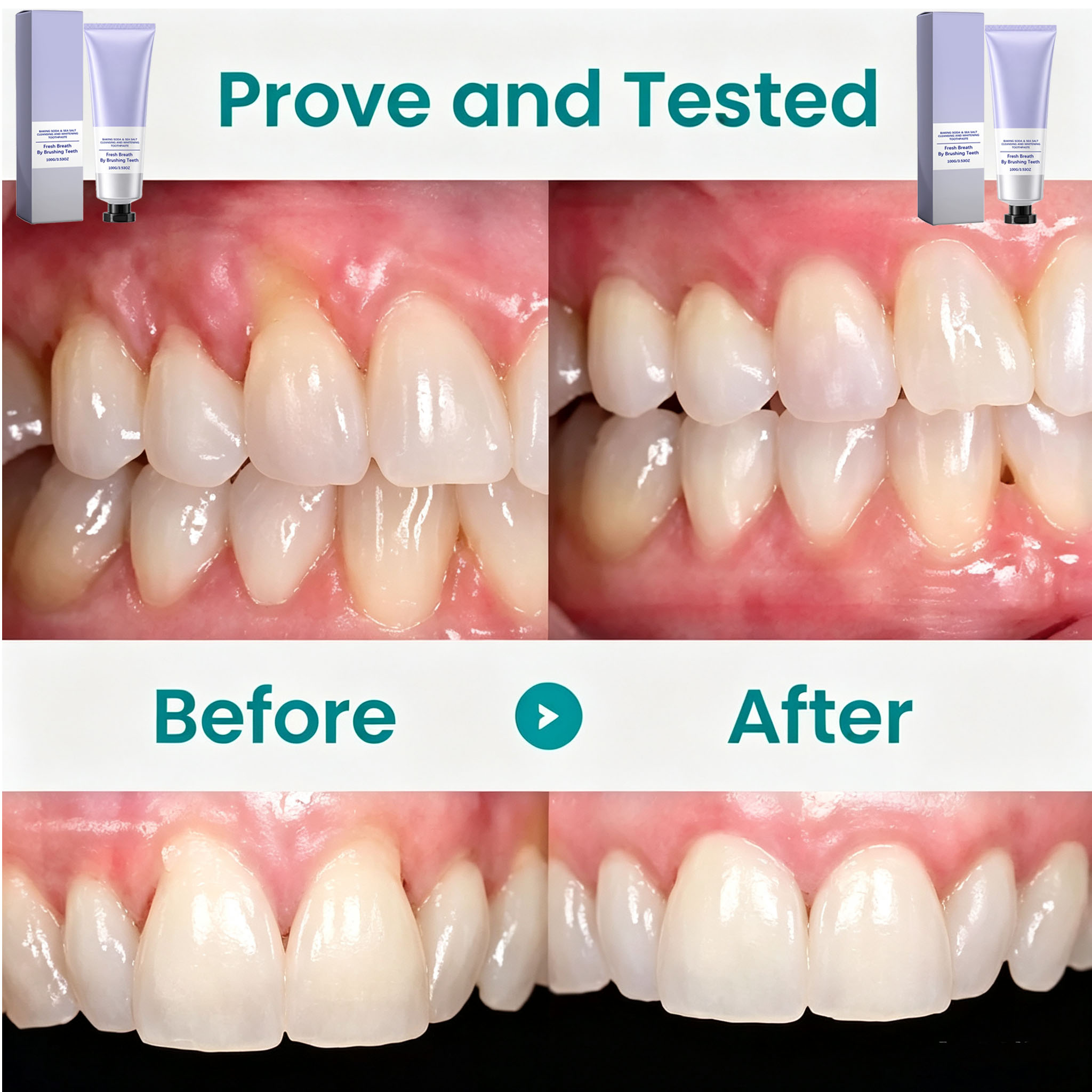 Baking Soda & Sea Salt Toothpa - đánh giá và giá Teeth Whitening With Baking Soda