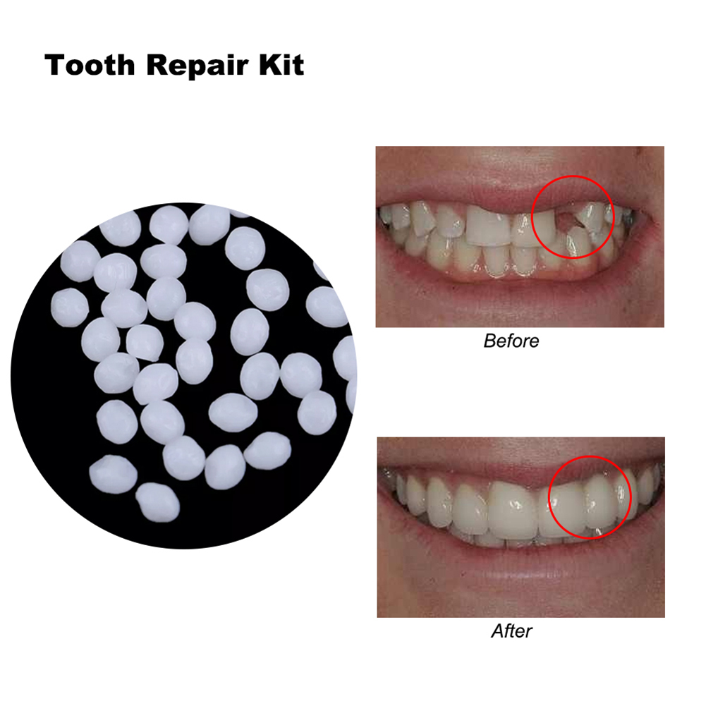 10/100g DIY Dentures Teether H - đánh giá và giá Teeth Whitening Diy