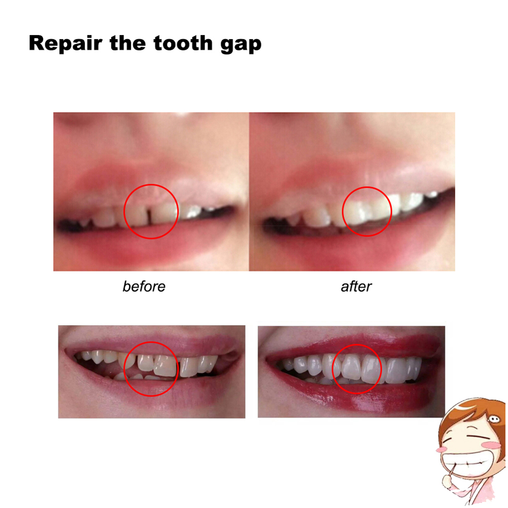 10/100g DIY Dentures Teether H - đánh giá và giá Teeth Whitening Diy
