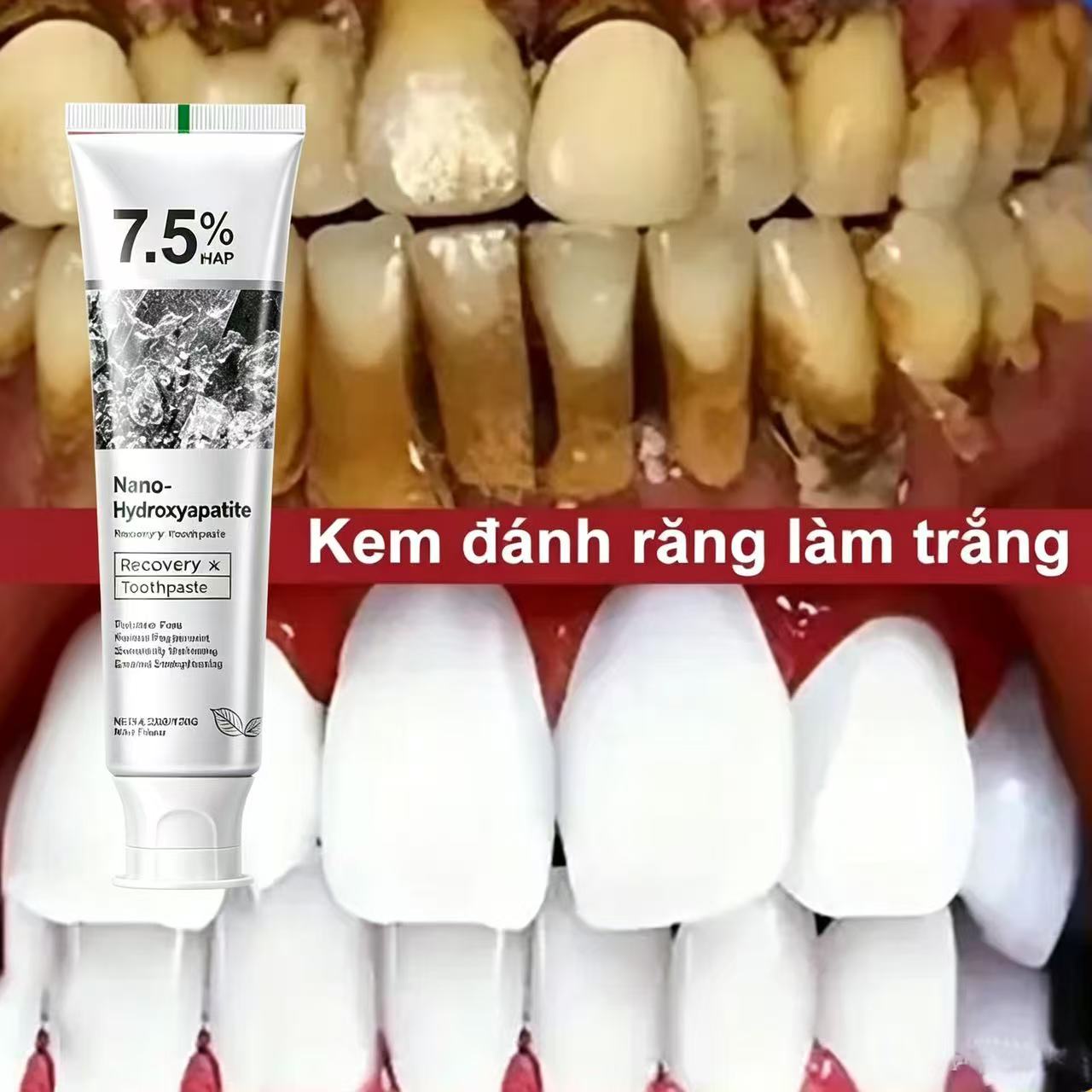 7.5% Hydroxyapatite Probiotic  - đánh giá và giá Hydroxyapatite Toothpaste
