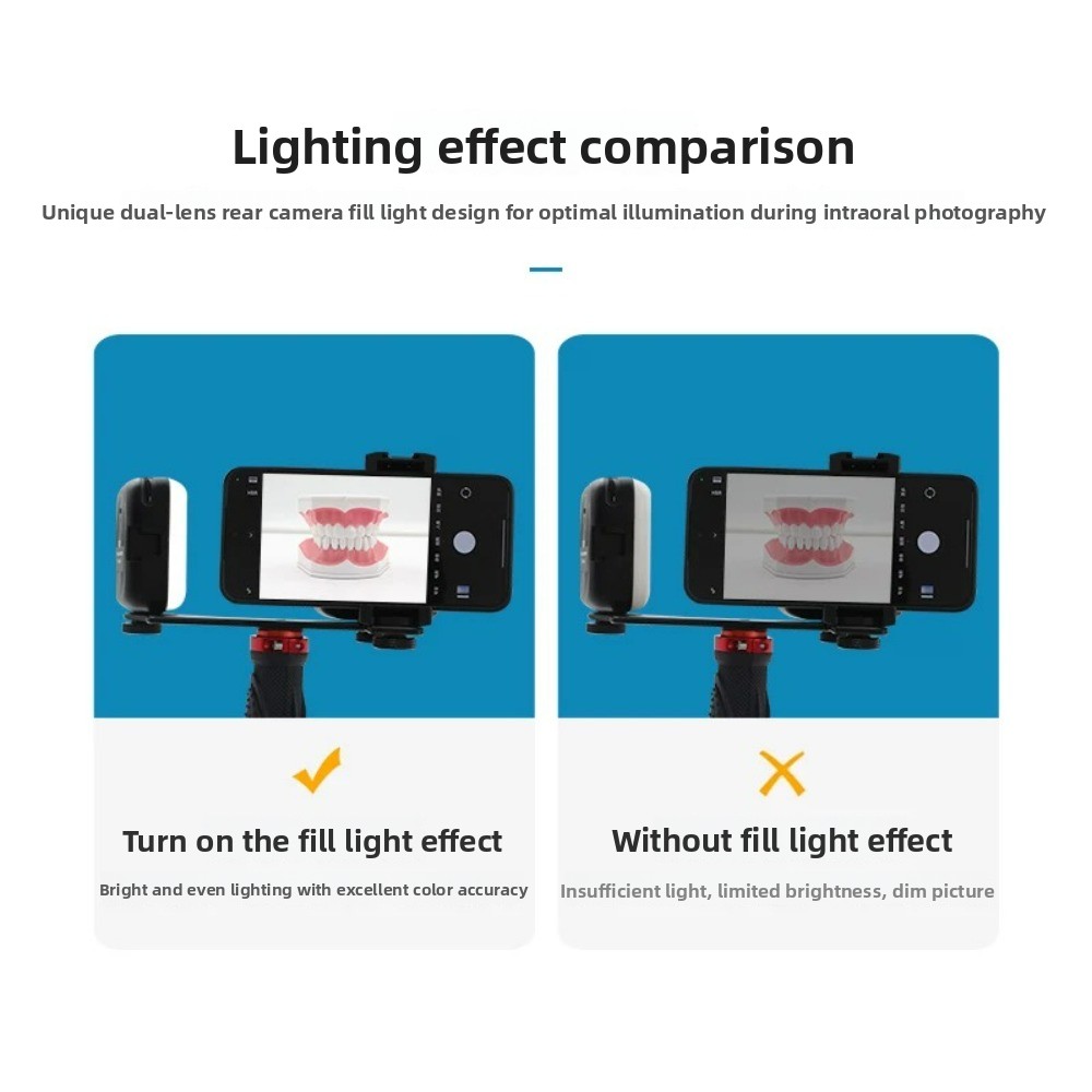 Dental Photography Light, Blue - đánh giá và giá Teeth Whitening Kit With Light