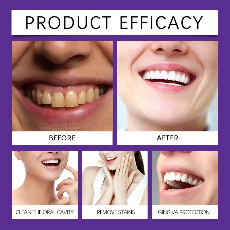 Purple Teeth Restoration Miner - đánh giá và giá Teeth Whitening Ingredients